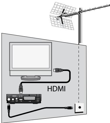 METRONIC ZAPBOX HD-SO.2 - A-Instalación simplificada - 1