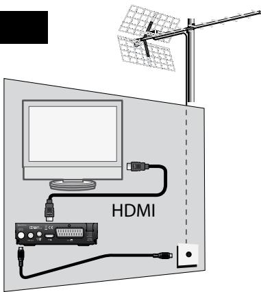 METRONIC ZAPBOX HD-SO.2 - A - Installation simplifiée - 1