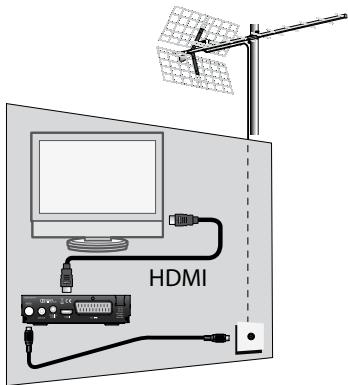 METRONIC ZAPBOX HD-SO.2 - A-Installazione amplificata - 1