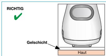 BRAUN IPL VENUS NAKED SKIN BY - WICHTIG: - 1