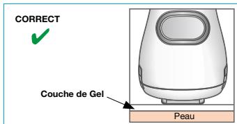 BRAUN IPL VENUS NAKED SKIN BY - IMPORTANT: - 1