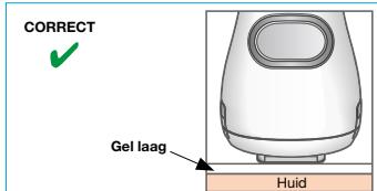 BRAUN IPL VENUS NAKED SKIN BY - BELANGRIJK: - 1
