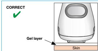 BRAUN IPL VENUS NAKED SKIN BY - IMPORTANT: - 1