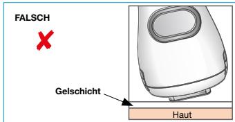 BRAUN IPL VENUS NAKED SKIN BY - WICHTIG: - 2
