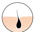 BRAUN IPL VENUS NAKED SKIN BY - Come funziona - 1