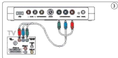PHILIPS SPV3000 - Vorsicht - 2