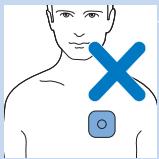 PHILIPS PR3098/00 - Symbole auf der Elektrodentesche - 5
