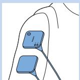 PHILIPS PR3098/00 - Elektroden und TENS-Komponenten befestigen - 6