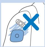 PHILIPS PR3098/00 - Symboles sur le sachet des electrodes - 2