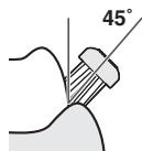 PANASONIC EW-DE92 - Para el límite entre la superficie de los dientes o los dientes y las encías - 1