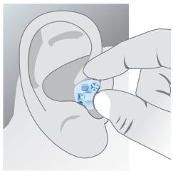 SIEMENS NITRO - Retrait de votre intra-auriculaire : - 1