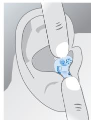 SIEMENS NITRO 16 - Mise en place de votre intra-auriculaire : - 2