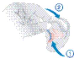 SIEMENS MOTION 501 BTE - Herausnehmen - 1