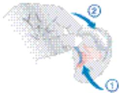 SIEMENS MOTION 701 - Inserimento dell'apparecchio acustico - 1