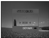 SUPPRIMER UI HOM DEFINR: