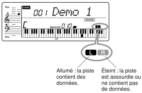 YAMAHA PSR-E223 - Assourdissement - 2