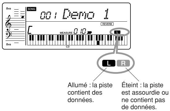 YAMAHA YPT-220 - Assourdissement - 2