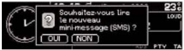 PEUGEOT NAVTEQ RT3 - La synthèse vocale. - 1