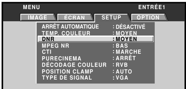 PIONEER PDA-5003 - Réduction du bruit vidéo (DNR) - 5