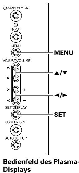 PIONEER PDA-5003 - Vermindern des Videorauschens (DNR) - 1