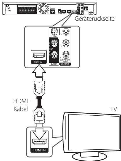 PIONEER BCS-313 - HDMI-Anschluss - 1