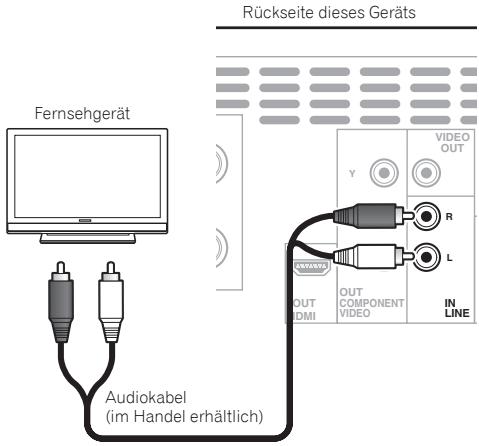 PIONEER X-HM31DAB-K - Hinweis - 1