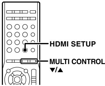 KENWOOD KRF-V5450D - Synchronisation des lèvres (KRF-V6400D seulement) - 8