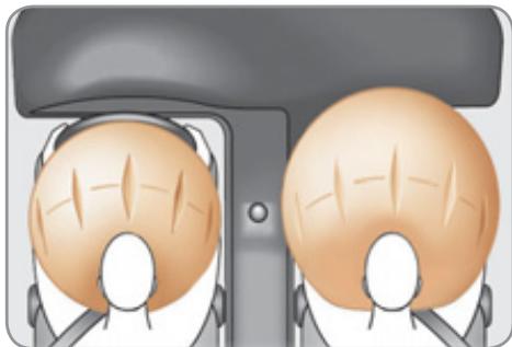 CITROEN C3 II - Airbags frontaux - 1