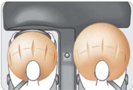 CITROEN C4 II - Airbags frontaux - 1