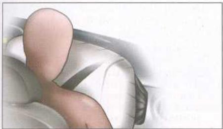 CITROEN XSARA 2003 - IMPORTANT - 1