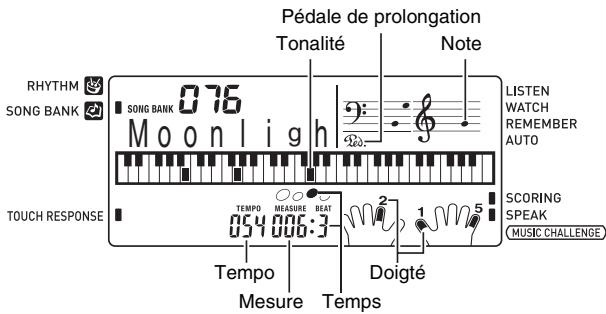CASIO CTK-3000 - Appuyez sur 10. - 1