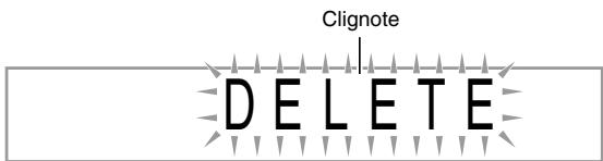 CASIO WK-200 - Suppression des données de chansons personalisées - 1