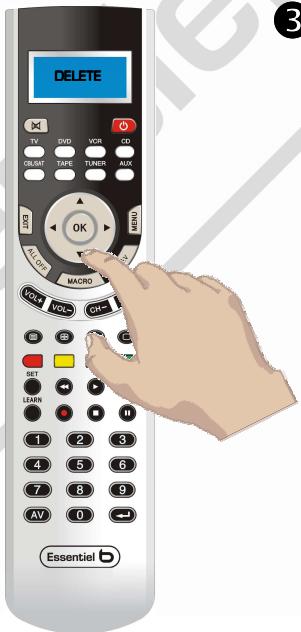 ESSENTIELB QUATUOR - Suppression de macros - 2