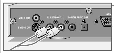 GRUNDIG GDP 1100/2 - Raccordement de la chaîne audio avec son stéréo analogue à deux canaux - 2