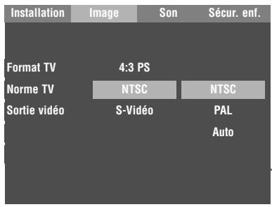 GRUNDIG GDP 1100/2 - Réglage de la norme TV - 1