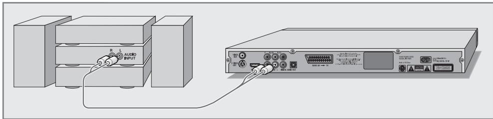 GRUNDIG GDP 3760 - Raccordement de la chaîne audio avec son stéréo analogue à deux canaux - 1