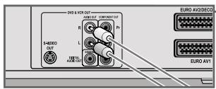 GRUNDIG GDR 6460 VCR SILVER * - Raccordement de la chaine audio avec son stéreo analogue à deux canaux - 3