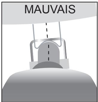 METRONIC 441322-5 - Montage de la parabole sur le moteur - 3