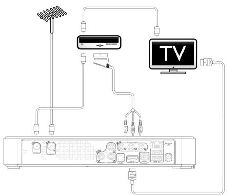LISTO AM L2 - External decoder set up - 1
