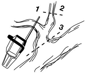 JONSERED CS 2117 EL - ATTENTION! - 1