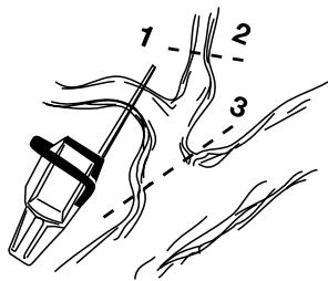 JONSERED CS 2121 EL - ENTASTEN - 2