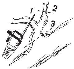 JONSERED CS 2255 - Entasten - 1