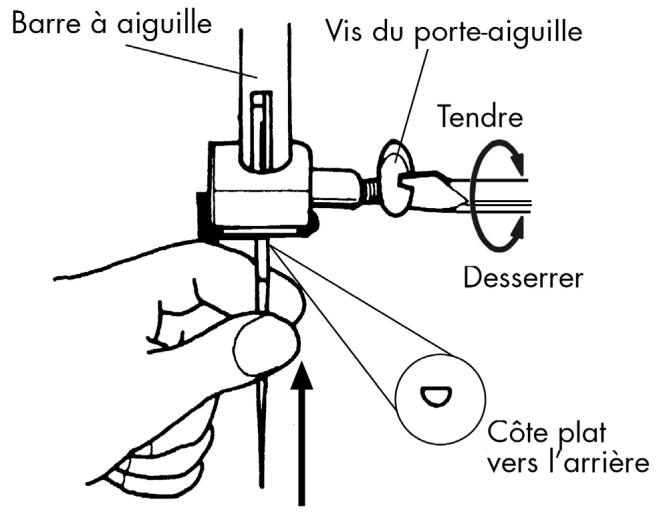 MEDION BDA10964 - Remplacer laiguille - 1