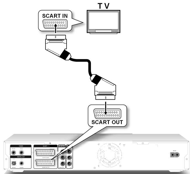 MEDION BDA81477 - Met SCART-kabel - 1