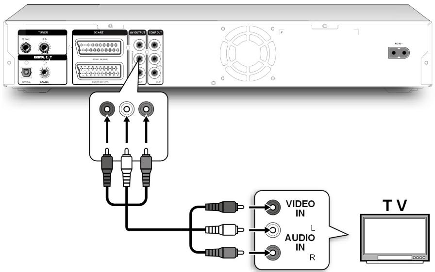 MEDION BDA81477 - Avec un câble cinch (câble audio-vidéo) - 1