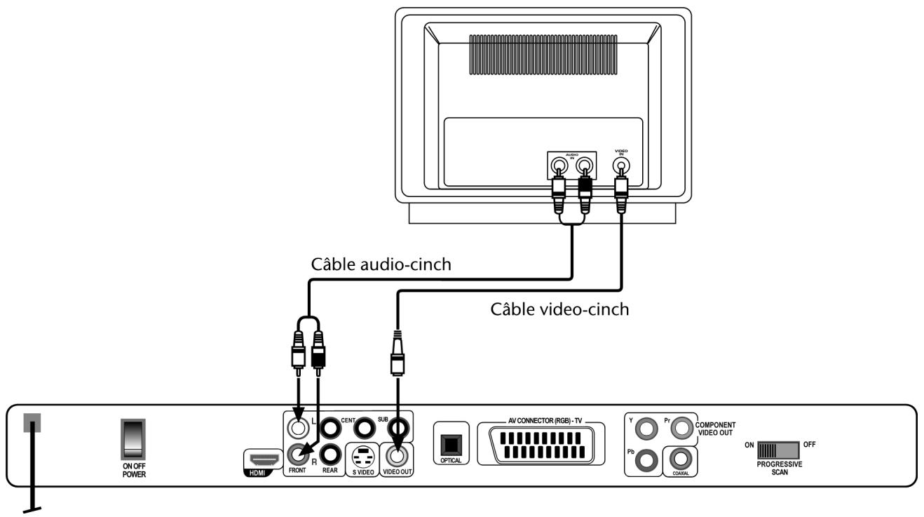 MEDION LT 81290 - Raccordement au téléviseur au moyen d'un câble vidéo cinch - 1