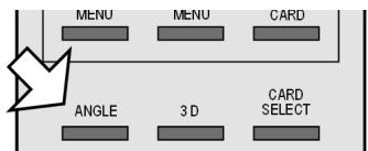 MEDION MD 81290 - Perspective - ANGLE (uniquement DVD) - 2