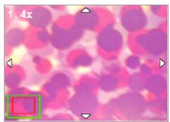 MEDION MD 85472 - Magnifying Images - 1