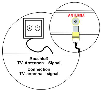 MEDION TFT DISPLAY MD 40830 - Anschlieben und Einschalten - 1