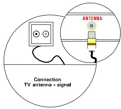 MEDION TFT DISPLAY MD 40830 - Conexión y encendido - 1